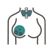 Breast endocrine surgery